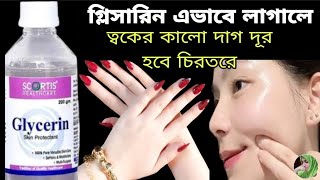 Glycerin এইভাবে একবার ত্বকে লাগিয়ে দেখুন,ত্বক হবে দাগহীন উজ্জ্বল ফর্সা টানটান/Winter skin care