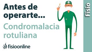 5 Cosas que debes de saber si vas a operarte de CONDROMALACIA ROTULIANA o desgaste de rótula