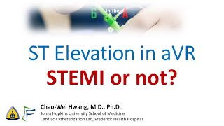 ST Elevation in aVR: STEMI or not?