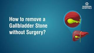 How to remove Gallbladder Stone without surgery?