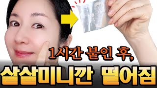 10년20년 묵은 기미, 잡티 긁으면 사라집니다~