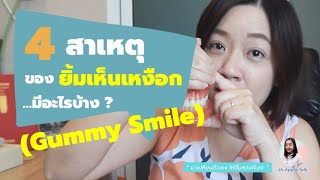 4 สาเหตุของยิ้มเห็นเหงือก ( Gummy Smile ) มีอะไรบ้าง?