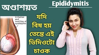 Epididymitis | Pain In Testicles | Assamese General Knowledge