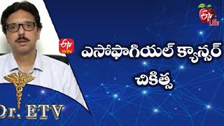 Esophageal Cancer - Treatment |ఎసోఫాగియల్ క్యాన్సర్ చికిత్స |Dr.ETV | 24th  November 2021| ETV Life