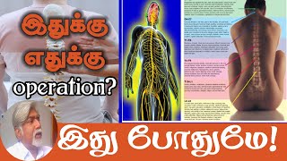 முதுகுத்தண்டு அறுவை சிகிச்சை தேவையா? இது போதும் அருமையான விழிப்புணர்வு | Yogam | யோகம்