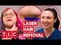 Dr. Emma Helps A Woman With Excess Facial Hair! | The Bad Skin Clinic