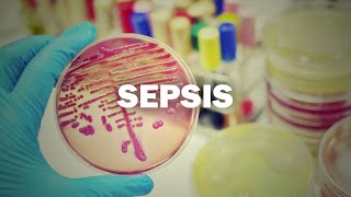 Reducing Sepsis Mortality
