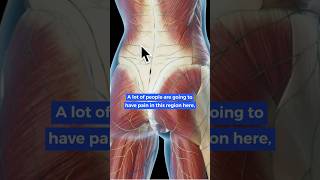 Is it SI Joint Pain or Back Pain?