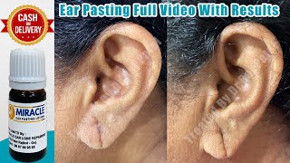 कान का छेद हमेशा के लिए छोटा करने का आसान तरीका / Ear Pasting Lotion /  Ear Lobe / Hole Repair / Ear
