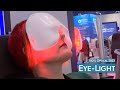 Dry eye treatment with the Eye-Light and Topcon