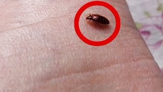 How Bedbug Drinks Human Blood ( ছারপোকা কীভাবে মানুষের রক্ত চোষে)