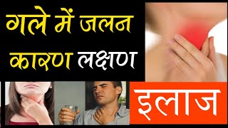 गले में जलन का इलाज | खाना गले में वापस आना खट्टी डकार आना | Burning sensation in throat, throat Rx