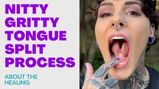About Healing a Tongue Split- Good, Bad and the Unexpected