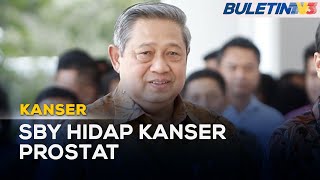 KANSER | Bekas Presiden Indonesia, Susilo Bambang Yudhoyono Hidap Kanser Prostat