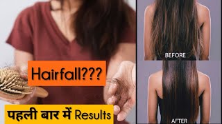 अगर बहुत Hairfall हो रहा है और कैसे भी Control नहीं हो रहा है तो इसको एक बार  लगा लो | 100% Results