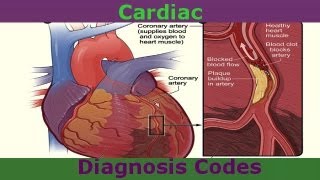 Common Cardiac Diagnosis Codes You Need To Know