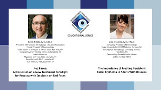 Red Faces and Understanding the Evaluation and Management of Persistent Facial Erythema in Adults wi