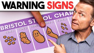 Does Your Poop Look Like This? (Signs You’re NOT Healthy)