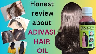 Honest Adivasi Hair Oil Review | फायदा या फिर नुकसान|Adivasi Hair Oil Real Or Fake😱| Beautiful Hair