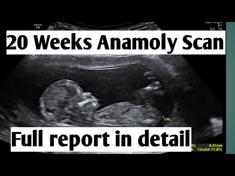 20 Weeks Anamoly Scan In Detail|Placenta Position And Baby Organs ...