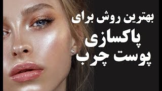 بهترین روش برای پاکسازی پوست چرب