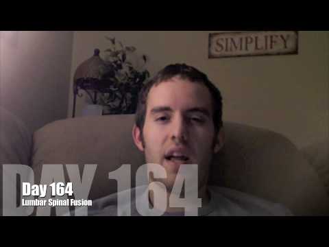 Spinal Fusion Part 11 Youtube