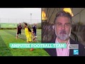 Gaza football team brings together players with amputated limbs