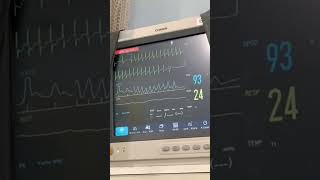 Adenosina: A medicação de emergência para taquicardia supraventricular