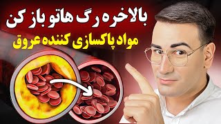 پاکسازی و بازکردن رگ های خونی در خانه با 8 دارو خانگی ارزان! Get Rid of Plaque in Blood Vessels