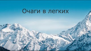 Очаги в легких