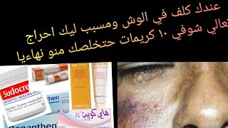 ١٠ كريمات حتخلصك من كلف الوجه نهاءيا #كلف_الوجه