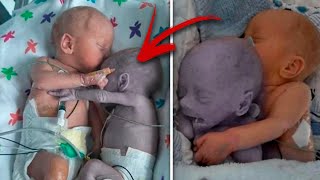 Mom puts the baby to the dying Twin and five minutes later a real Miracle happens... | PLOT