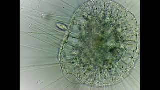 Superclass Actinopoda (Actinosphaerium) kills a ciliate!!!  (2x speed)