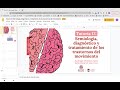 tutoría 12 semiología diagnóstico y tratamiento de los trastornos del movimiento