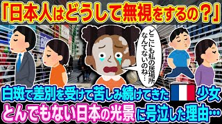 【2ch海外の反応】「日本人はどうして無視をするの？」白斑で差別を受けて苦しみ続けてきたフランス人少女がとんでもない日本の光景に号泣した理由…【ゆっくり解説】