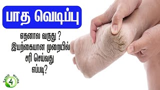 பாத வெடிப்பு எதனால் வருது? அதை குணமாக்குவது எப்படி?Cracked-heels home remedy