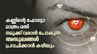 കണ്ണിന്റെ ഫോട്ടോ മാത്രം മതി, നമുക്ക് വരാൻ പോകുന്ന അസുഖങ്ങൾ പ്രവചിക്കാൻ കഴിയും | Eye Care | AI