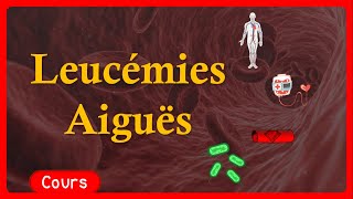 🎗️ Leucémie Aigue 🩸 : symptômes🤧,  traitements💉 - Cours - Hématologie