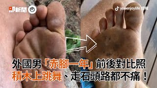 男子赤腳一年後... 走石頭路都不痛了！｜腳底｜光腳｜神人