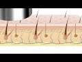 Advantest Hadatomo™ Z Photoacoustic Microscope