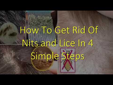 How To Get Rid Of Nits and Lice In 4 Simple Steps How To Get Rid Of Nits and Lice In 4 Simple Steps