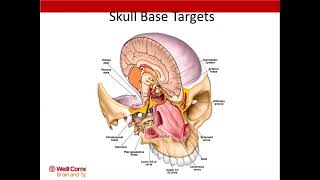 Neurosurgery On the Go: Anatomy for Skull Base Approaches