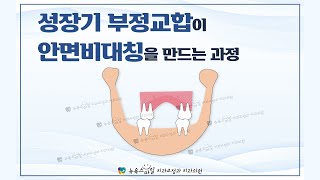 성장기 부정교합이 안면비대칭을 만드는 과정 [울산/포항비수술비대칭교정 - 뉴욕스마일 치과교정과치과의원]