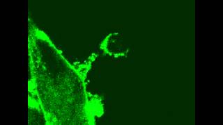 Cytoplasmic Bridge Connecting Senescent Cell and NK Cell