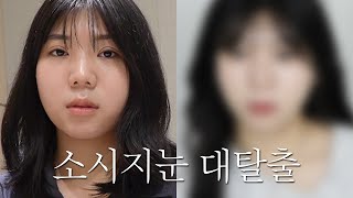 [여니 Vlog] 소세지눈으로 살다가 도저히 안 되겠어서 했는데 탈출 성공 QnA