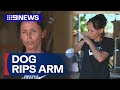 Mum says she doesn't blame her dog after it ripped her arm off | 9 News Australia