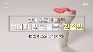 지옥 같은 고통 관절염! 수술 없이 내 무릎을 사수하라! MBN 230428 방송