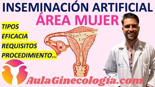 INSEMINACIÓN ARTIFICIAL: TIPOS, EFICACIA, REQUISITOS, PROCEDIMIENETO...- Ginecología y Obstetricia -