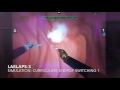 Robotic surgery game: LAELAPS-3 - Simulation, Curriculum, Energy Switching 1