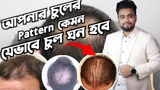 কিভাবে আপনার চুল পড়েছে | যেভাবে পাতলা চুল ঘন করবেন | চুল গজানোর উপায় | চুল পড়া বন্ধ করার উপায়